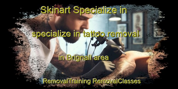 Skinart Specialize in specialize in tattoo removal in Brignall area | #RemovalTraining #RemovalClasses #SkinartTraining-United Kingdom