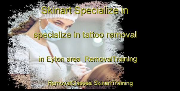 Skinart Specialize in specialize in tattoo removal in Eyton area | #RemovalTraining #RemovalClasses #SkinartTraining-United Kingdom