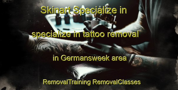 Skinart Specialize in specialize in tattoo removal in Germansweek area | #RemovalTraining #RemovalClasses #SkinartTraining-United Kingdom